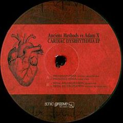 Ancient Methods Vs. Adam X - Cardiac Dysrhythmia EP - Sonic Groove